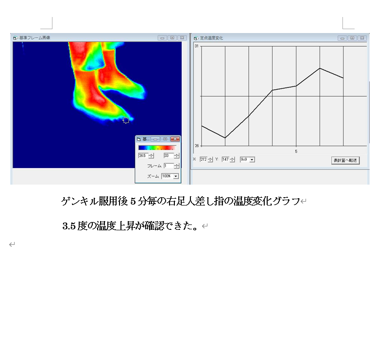 サーモグラフで温度上昇を実証しました 株式会社オーバーテイク 公式 アルギニンで強いカラダを作ろう